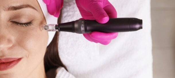 Microneedling for Different Skin Concerns