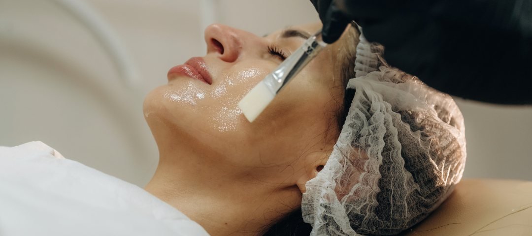 Chemical peel application